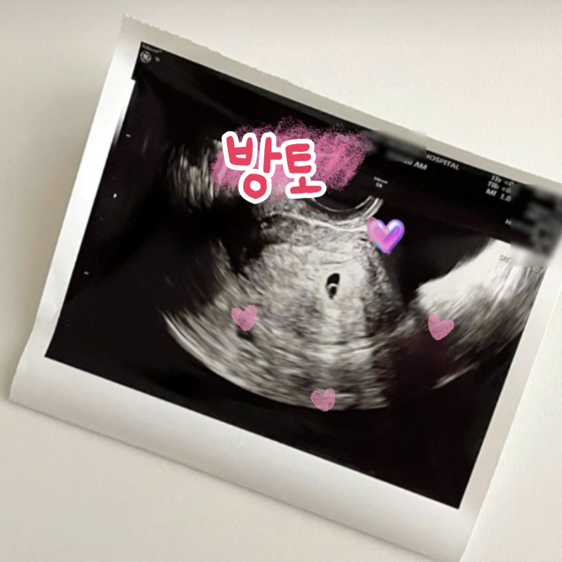 임산부 영양플러스 서울 신청 (지원사업 정리)