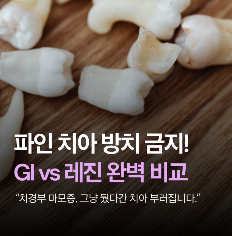 치경부 마모증 방치하면 신경치료까지? 파인 치아 잘 때우는 신논현역 인근 치과 선택법(GI vs....