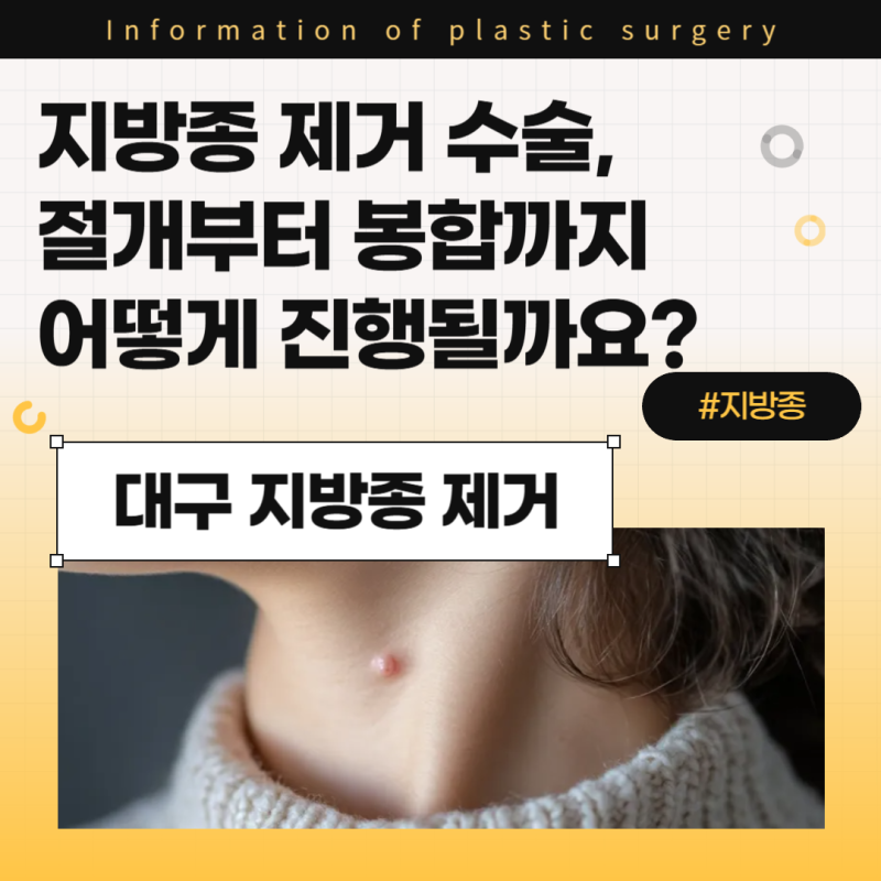 대구 지방종 제거 수술, 절개부터 봉합까지 어떻게 진행될까요?