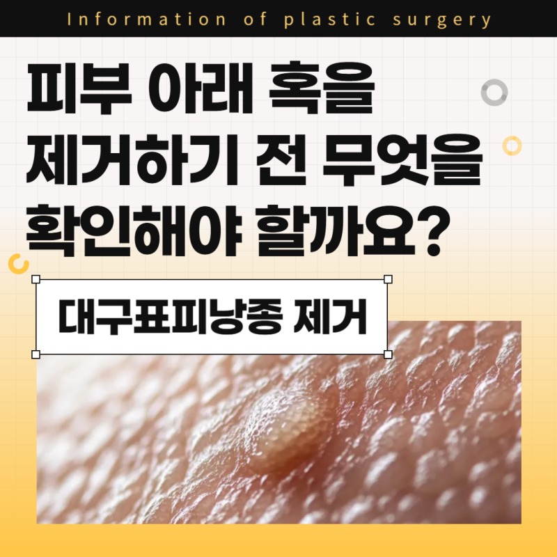 대구표피낭종제거병원, 피부 아래 혹을 제거하기 전 무엇을 확인해야 할까요?