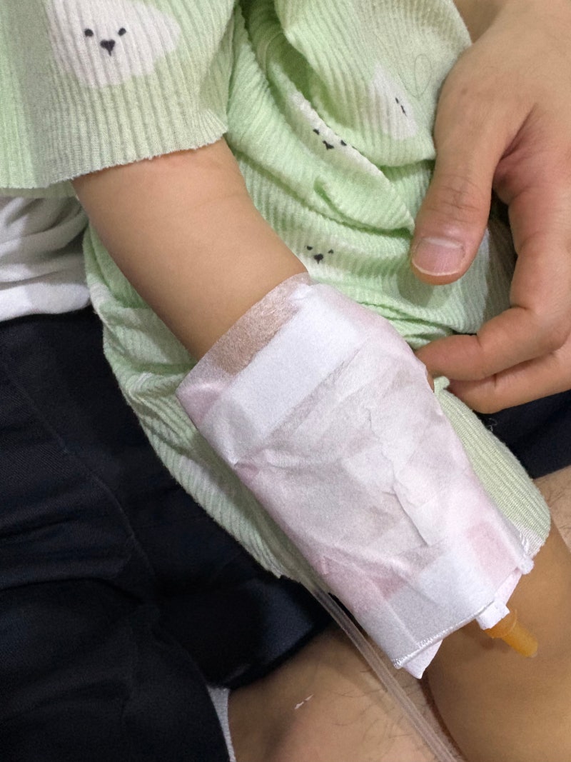 [FPIES 1편] 아기 계란 알레르기 구토, FPIES를 의심하게 된 첫 번째 입원