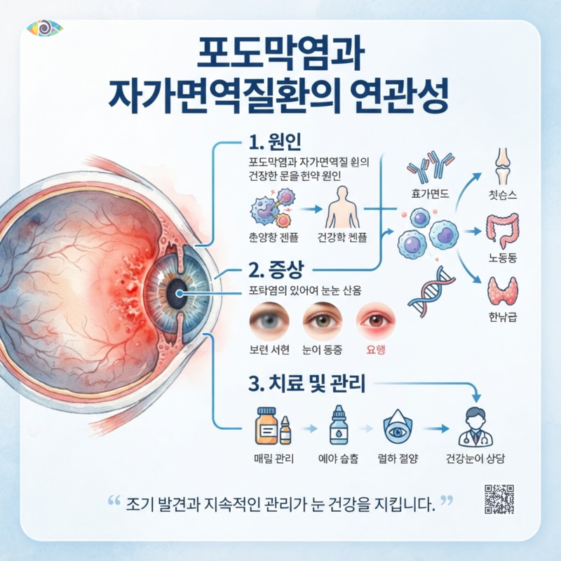 포도막염 자가면역질환 원인 증상 치료 연관성 완벽 정리