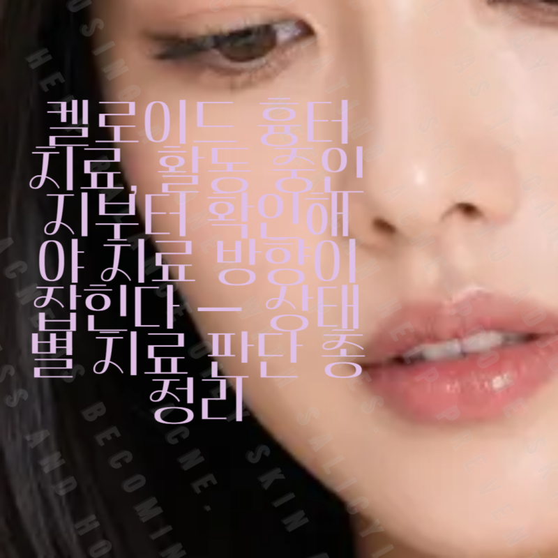 켈로이드 흉터치료, 활동 중인지부터 확인해야 치료 방향이 잡힌다 — 상태별 치료 판단 총....