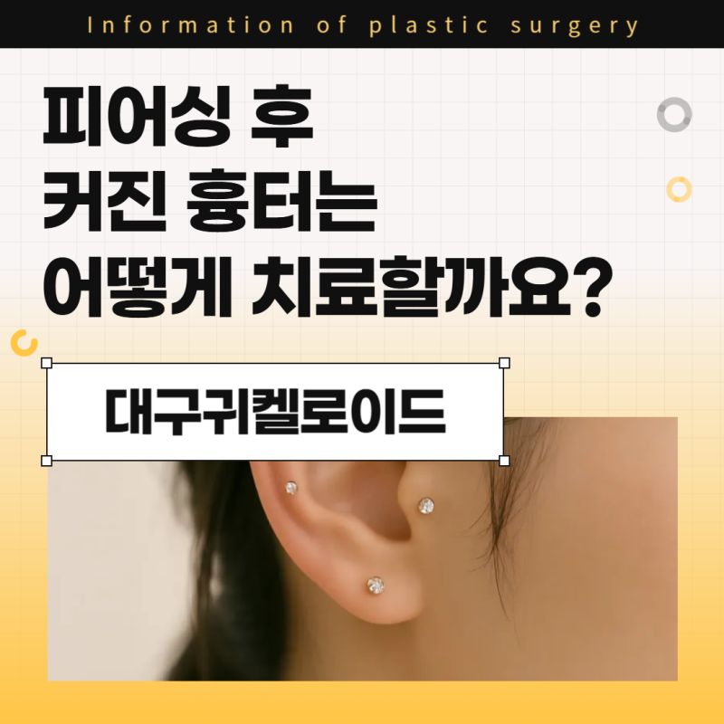대구귀켈로이드, 피어싱 후 커진 흉터는 어떻게 치료할까요?