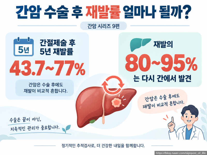간암 수술 후 재발률 얼마나 될까?5년 재발률과 재발 후 치료｜간암 시리즈 9편