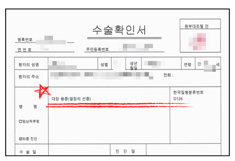 대장선종 보험금, 용종 하나 떼고 3,350만원 받은 이야기