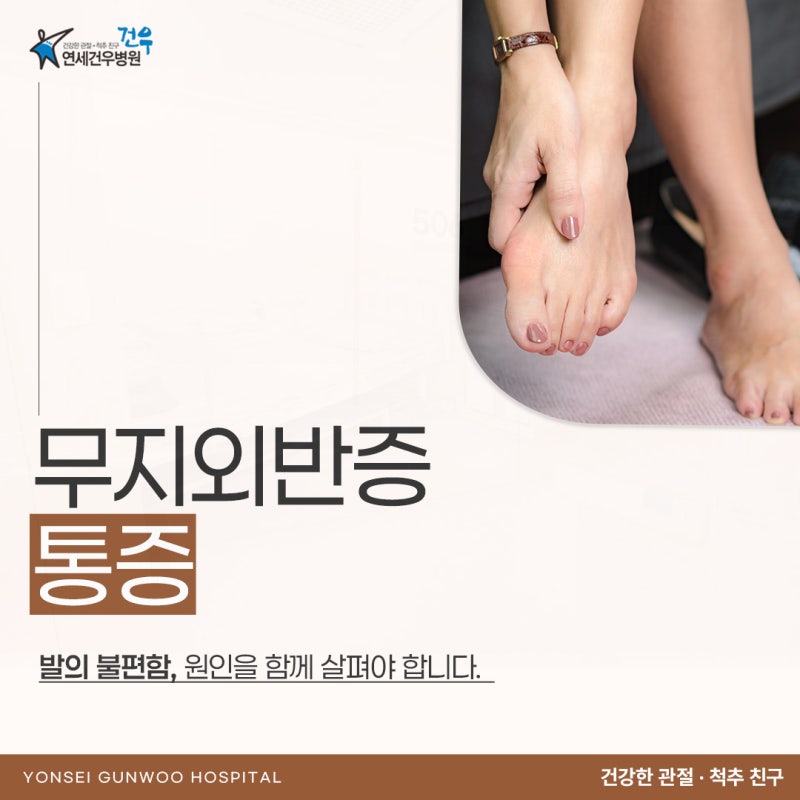 무지외반증 통증 왜 엄지가 아니라 발바닥과 발목까지 아플까요?