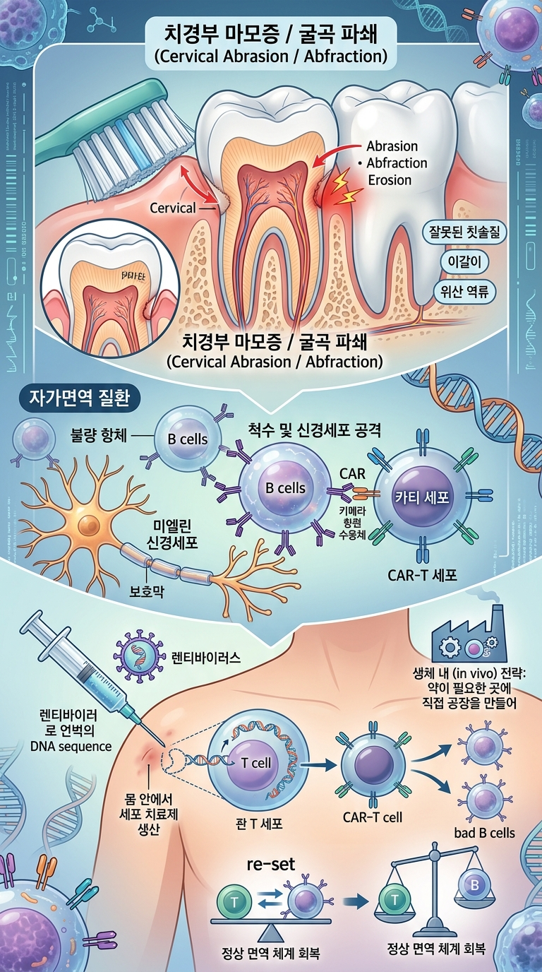 [질병탐정] 치아패임 이가 시리고 패였다면? 원인부터 치료·관리법까지 확인하기