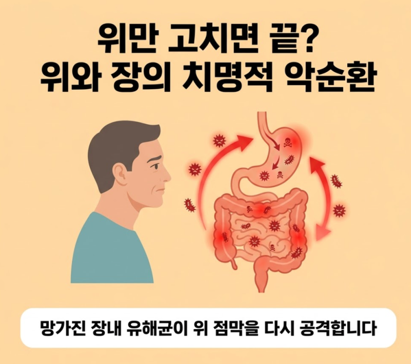 위 장상피화생, 위만 고치면 될까? 장이 문제일수도..