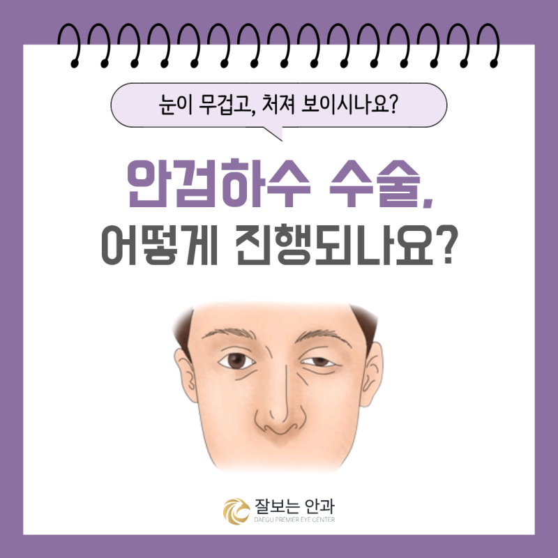 대구 안검하수 수술 방법이 사람마다 다른 이유는? 눈꺼풀올림근 기능이 중요합니다 | 잘보....