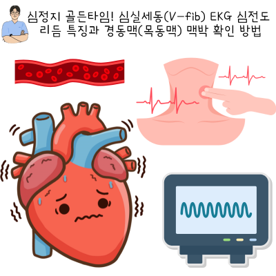 심정지 골든타임! 심실세동(V-fib) EKG 심전도 리듬 특징과 경동맥(목동맥) 맥박 확인 방법