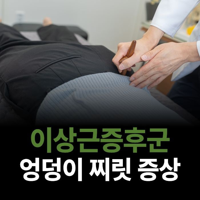 엉덩이가 찌릿하고 당기는데 뭐가 문제인가요? 이상근증후군의 원인과 치료 방법