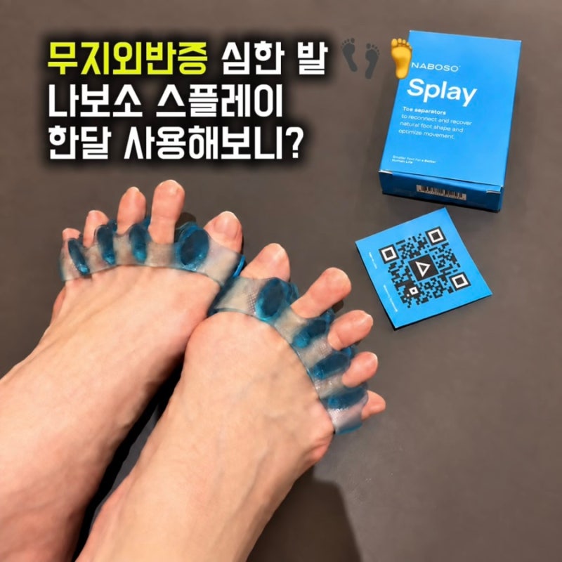 나보소 스플레이 한달 사용 후기, 무지외반증 효과가 있을까?