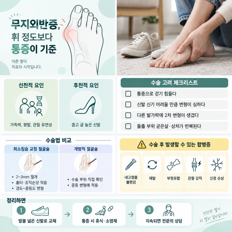 무지외반증 수술 시기, 발 휜 정도가 아니라 이 기준으로 판단하세요