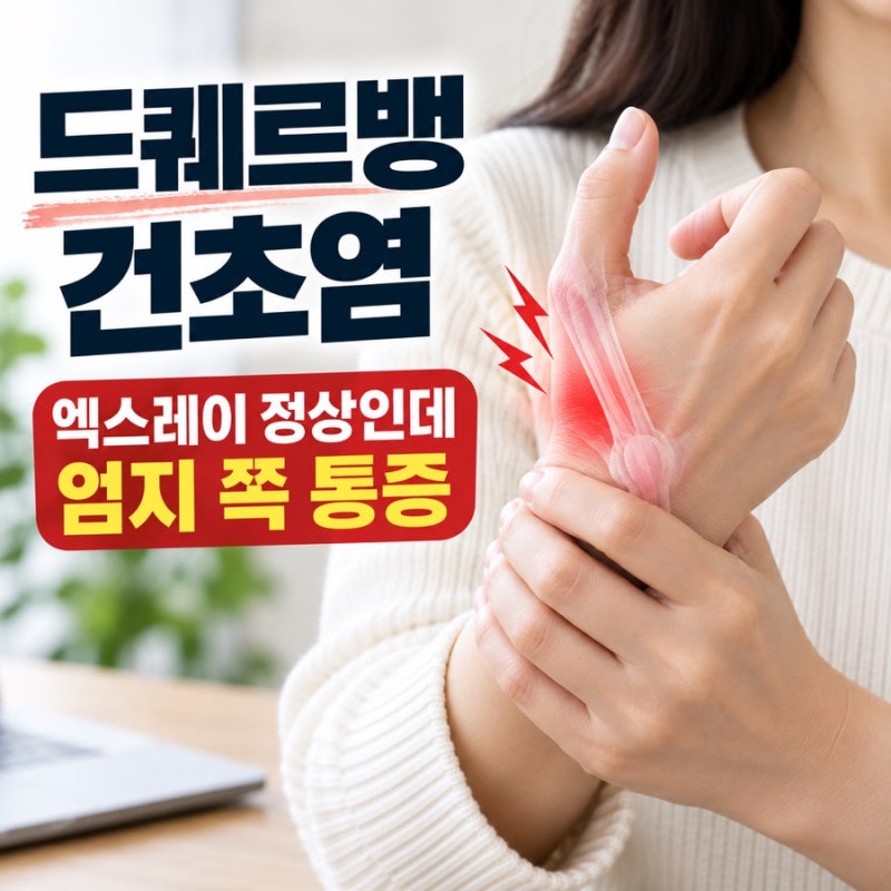 드퀘르뱅 건초염 엑스레이 정상인데 엄지 쪽 통증