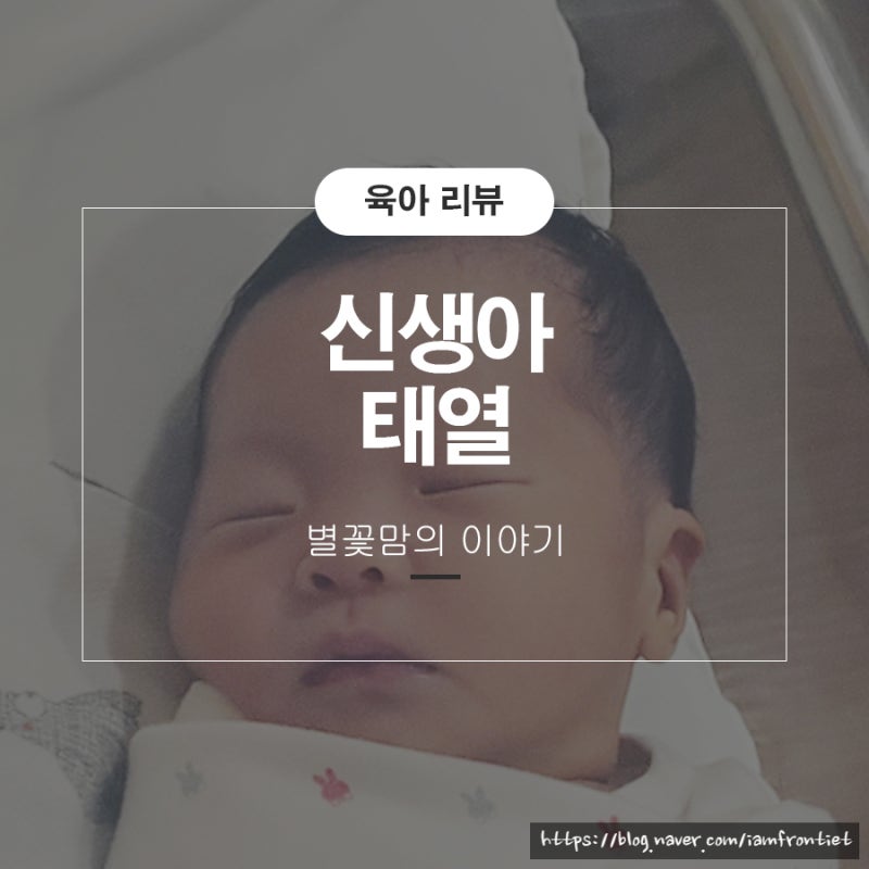 신생아 태열관리 아기 수딩젤 방법