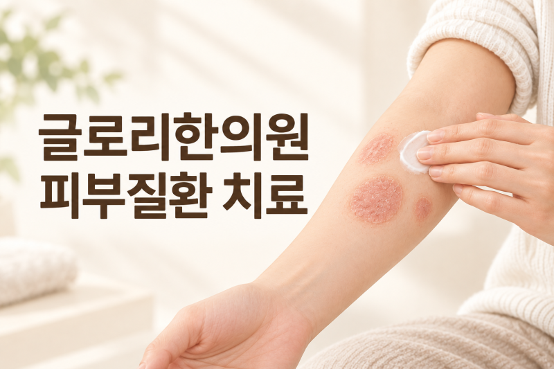 성북구 피부질환치료 : 화폐상습진, 동전 모양 습진과 진물·가려움이 반복되는 이유