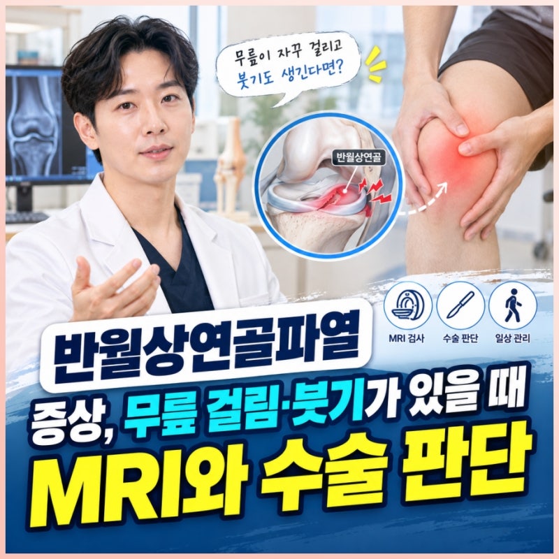 반월상연골파열 증상, 무릎 걸림·붓기가 있을 때 MRI와 수술 판단