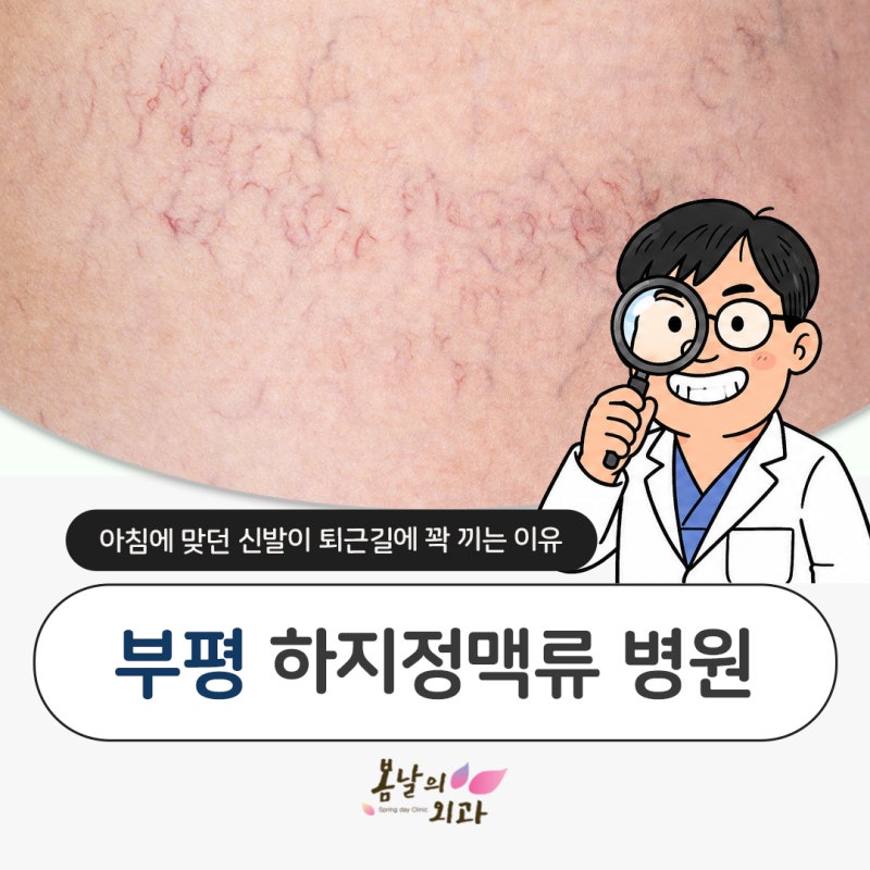 부평하지정맥류병원 신발이 퇴근길에는 꽉 끼는 이유는?