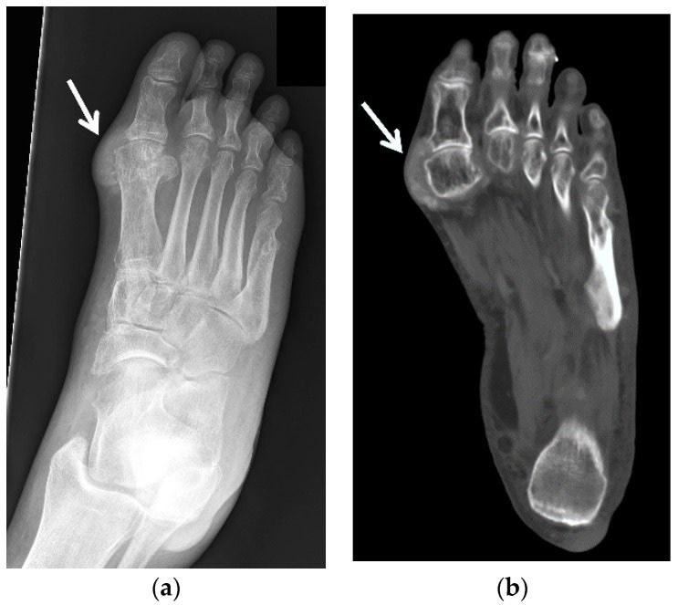 통풍 Gout 진료 검색 디렉토리 2026: 의료진·의료기관·검색 경로