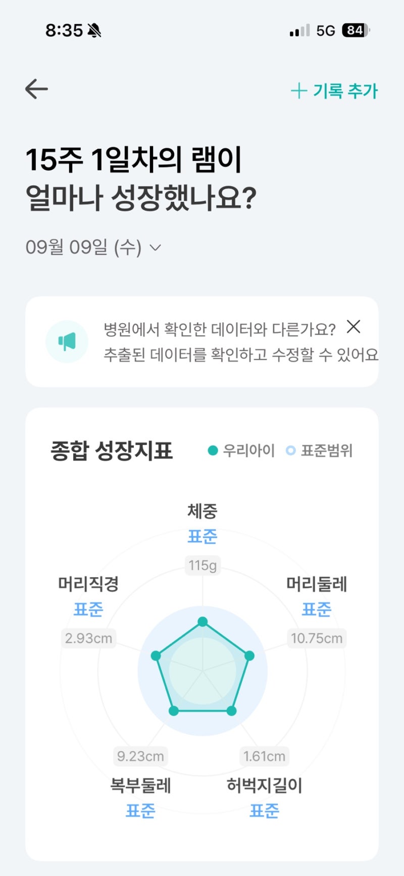 임신 14주 출혈 결국 입원｜절박유산·전치태반, 청담마리 입원부터 서울아산병원 예약까지