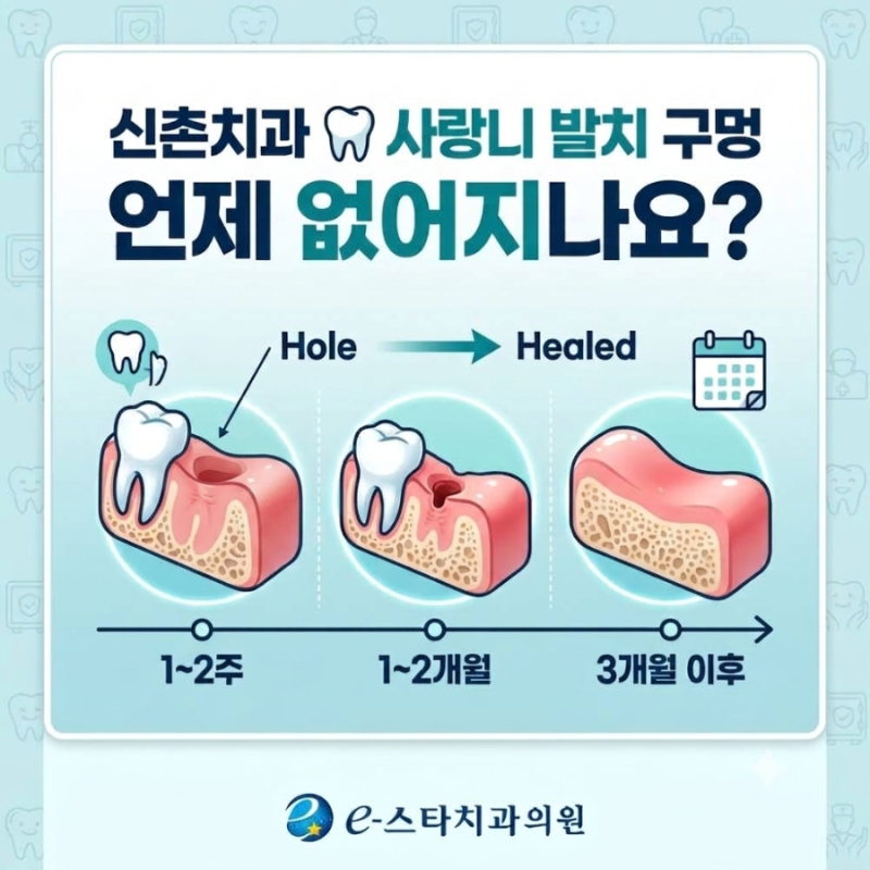 신촌치과 | 사랑니 발치 구멍,언제 없어질까요?