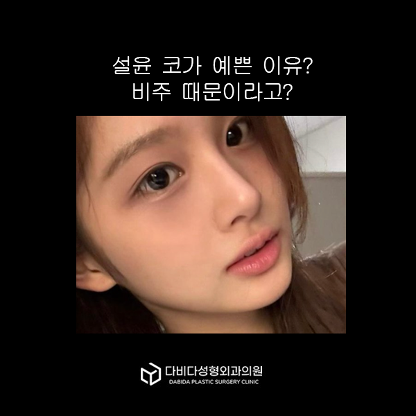 설윤 코가 예쁜 이유? 비주 때문이라고?