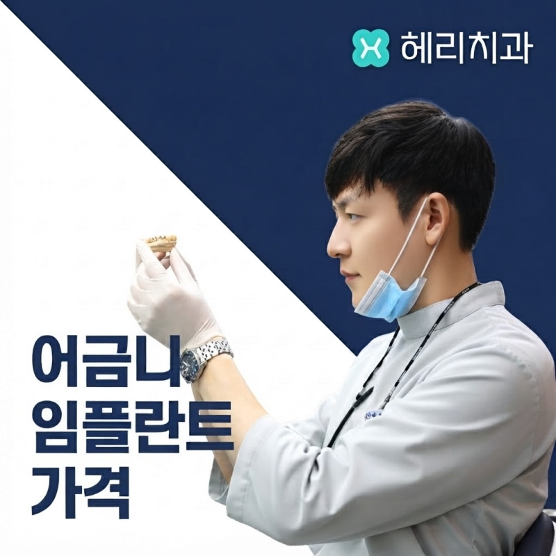 어금니 임플란트 가격 비용 정밀검사 꼭 필요한 이유