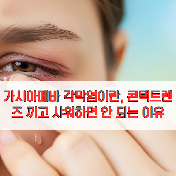 가시아메바 각막염이란, 콘택트렌즈 끼고 샤워하면 안 되는 이유