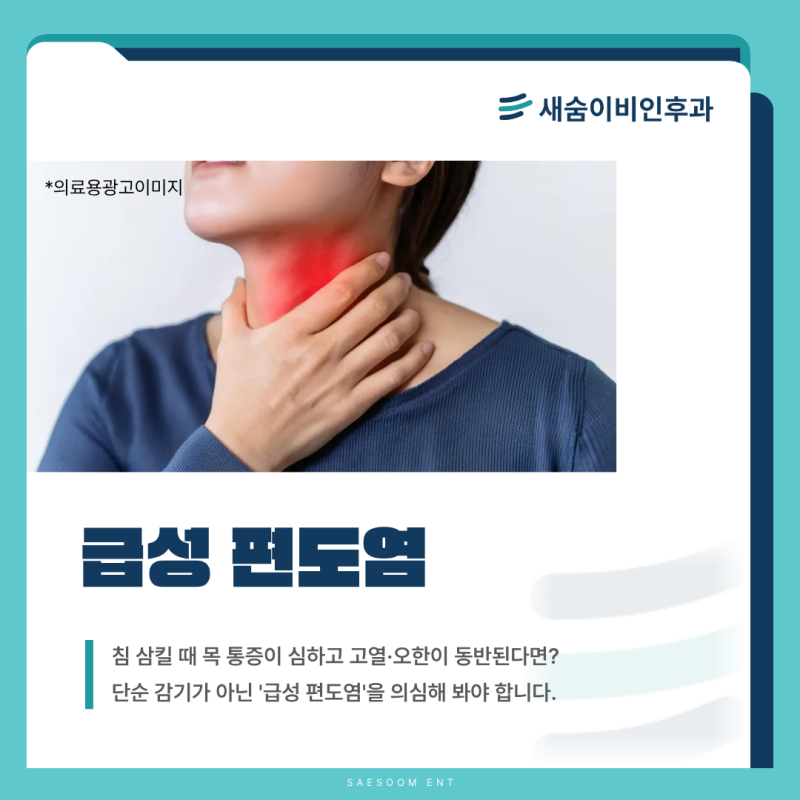 침 삼킬 때 목 통증, 단순 감기 아닌 '급성 편도염'? 환절기 증상과 예방법