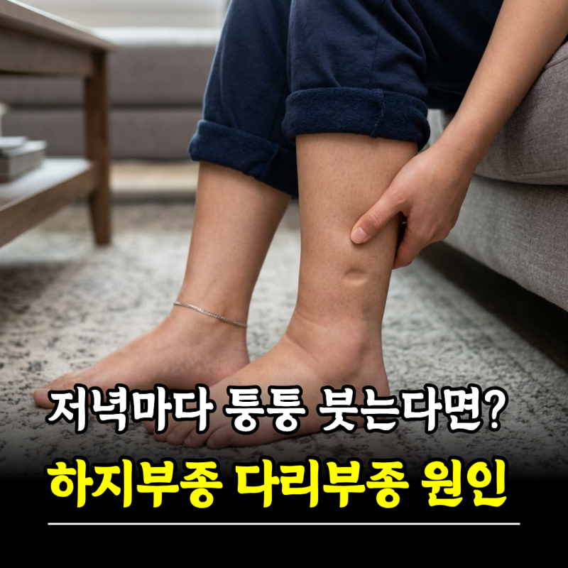 저녁마다 퉁퉁 붓는다면? 하지부종 다리부종 원인 증상