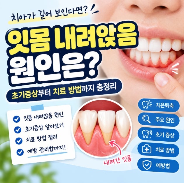 잇몸 내려앉음 원인부터 초기증상 치료 방법까지