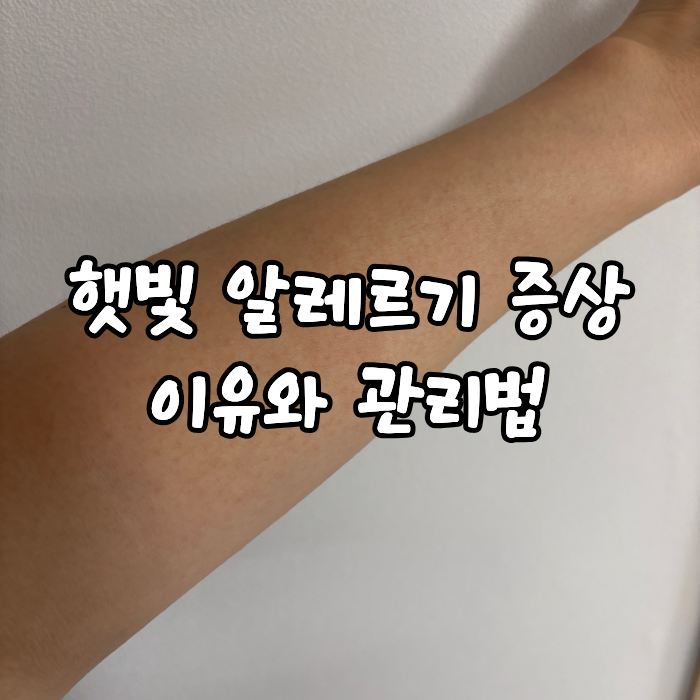 햇빛 알레르기 증상｜팔에 오돌토돌 발진이 생기는 이유와 관리법