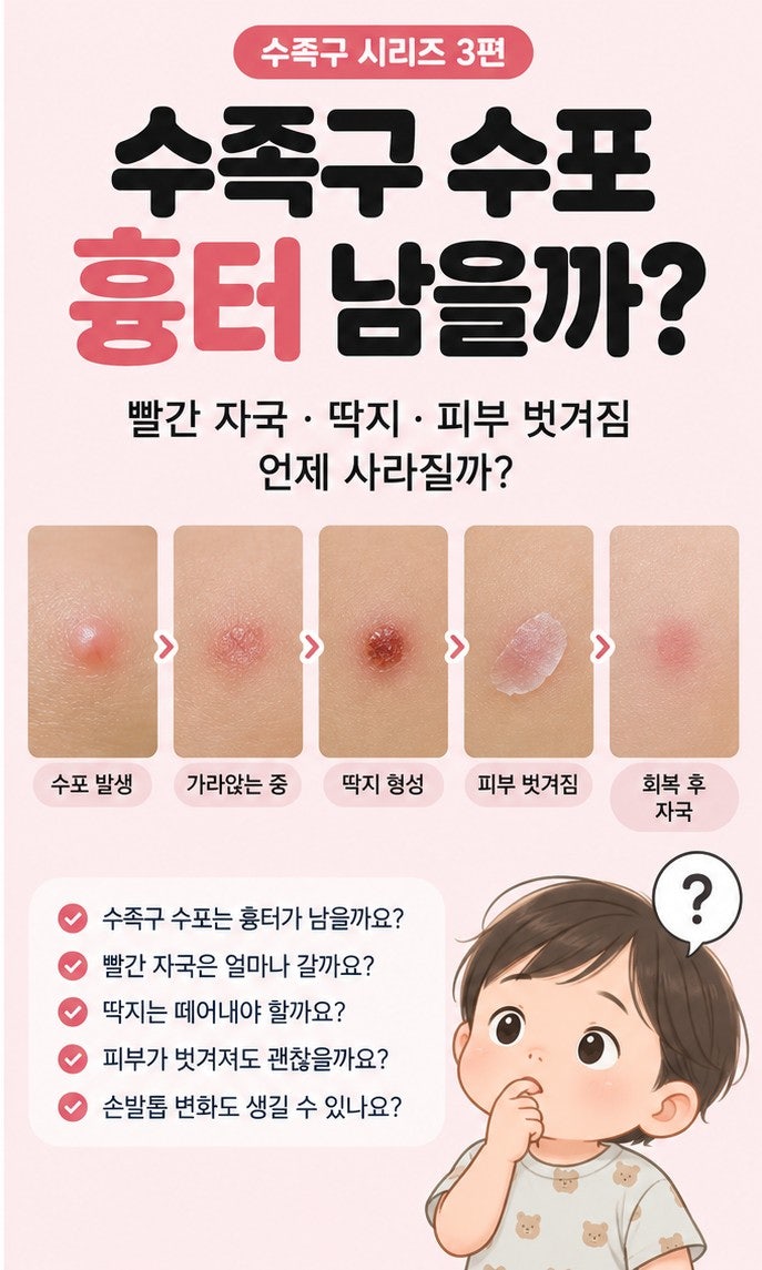 수족구 수포 흉터 남을까?｜빨간 자국·딱지·피부 벗겨짐 언제 사라질까