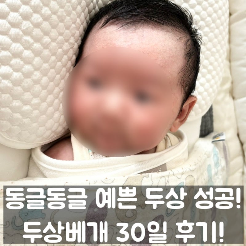 아기 엘라바 두상베개 비포애프터! 아기 신생아 두상케어 및 태열 잡는 솔직 섭취후기