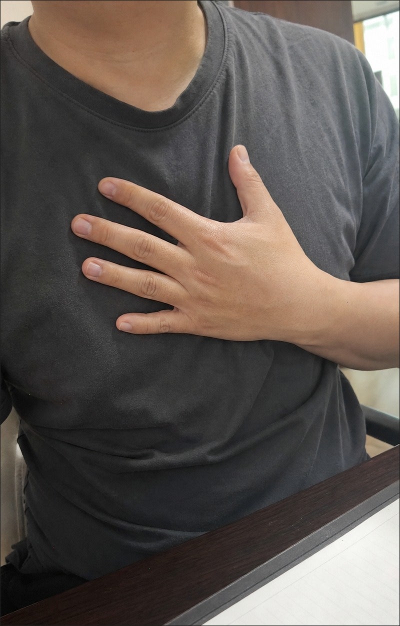 남자 왼쪽 가슴 통증, 심장 문제일까? 원인별 구분법 총정리