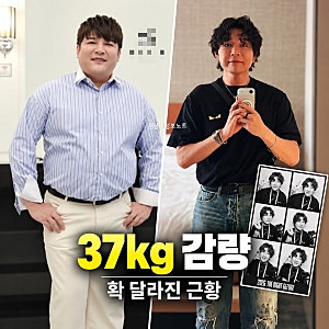 신동, 위고비 중단 후 37kg 감량 성공…확 달라진 비주얼에 “요요 걱정”까지