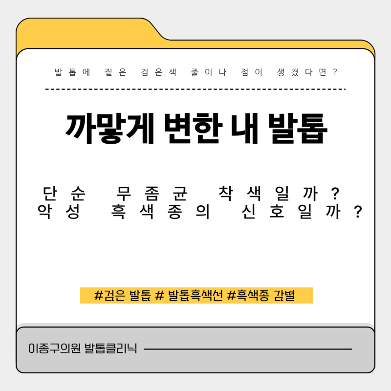 [안양무좀병원] 까맣게 변한 내 발톱, 단순 무좀일까? 악성 흑색종의 신호일까?