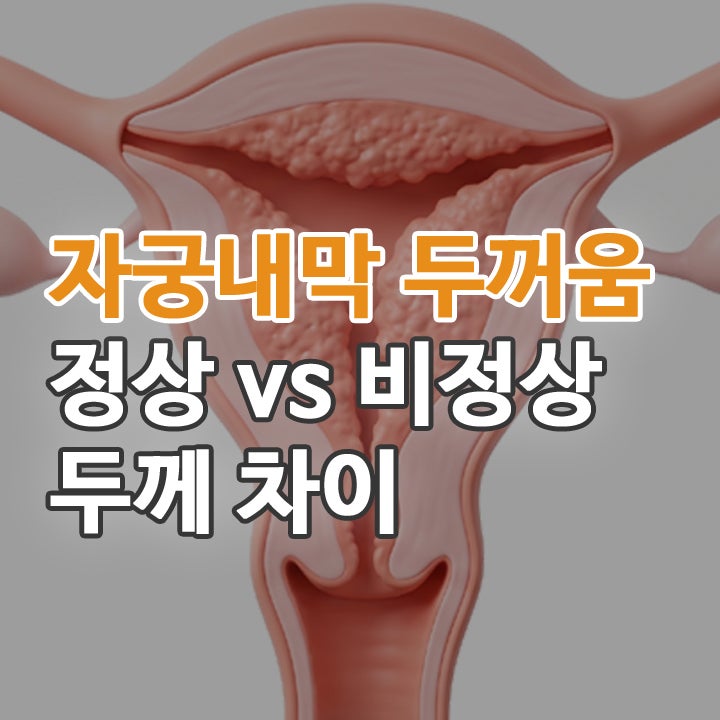 자궁내막증식증 자궁내막 두꺼움 정상 두께 차이