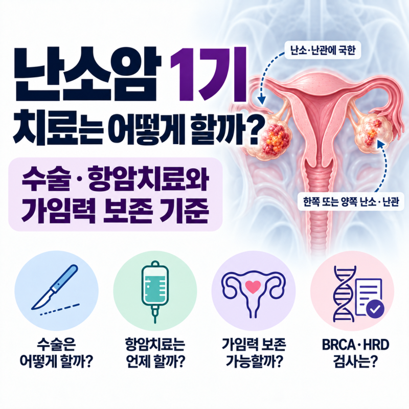 난소암 1기 치료는 어떻게 할까? 수술·항암치료와 가임력 보존 기준