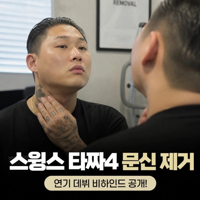 스윙스 타짜4 문신 제거 배우 데뷔 비화