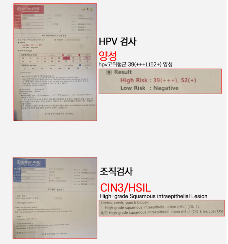 자궁경부이형성증 검사 CIN1·CIN2·CIN3 ASCUS·LSIL·HSIL 치료와 재발 관리의 기준