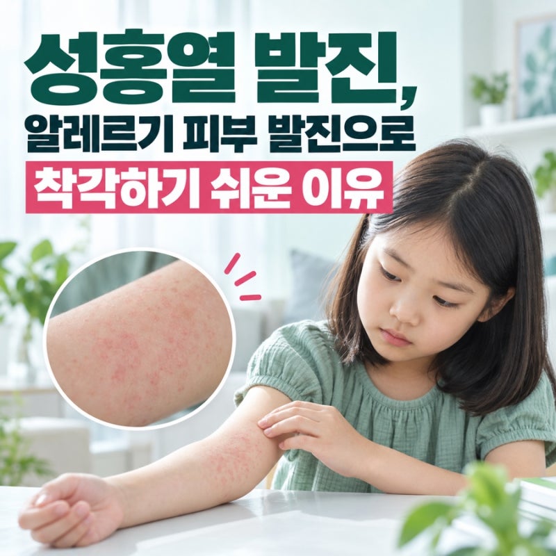 성홍열 발진, 알레르기 피부 발진으로 착각하기 쉬운 이유