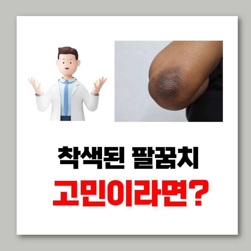 흑꿈치를 하얗게 되돌리고 싶어요!!