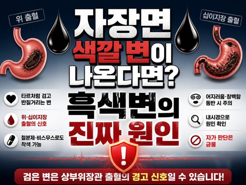 화장실에서 변 색깔이 갑자기 까맣게 나온다면? 흑색변 원인과 위장관 출혈 신호