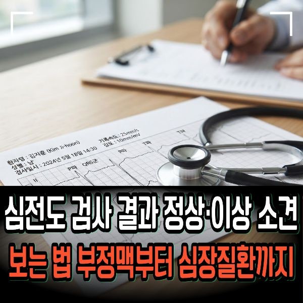 심전도 검사 결과 정상·이상 소견 보는 법 부정맥부터 심장질환까지