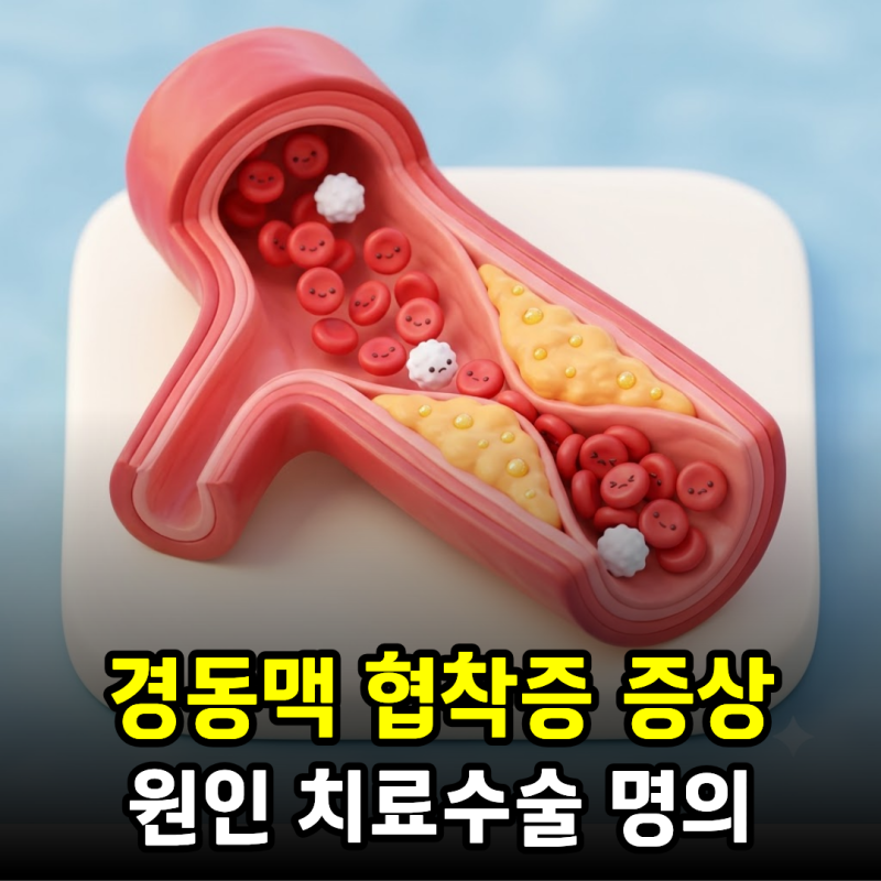 경동맥 협착증 증상과 원인, 치료와 수술 그리고 명의