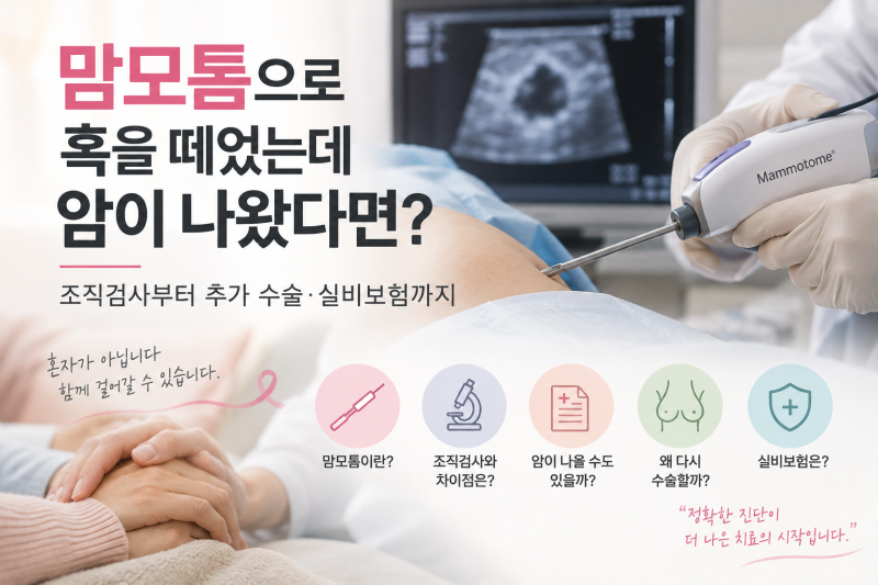 맘모톰으로 혹을 떼었는데 암이 나왔다면? 조직검사부터 수술·실비보험까지