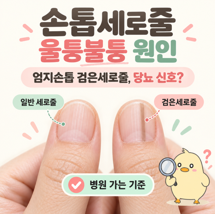 손톱세로줄, 울퉁불퉁 원인, 엄지손톱 검은세로줄 당뇨 신호?