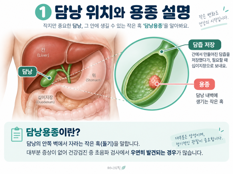 담낭용종, 이래서 생겨요